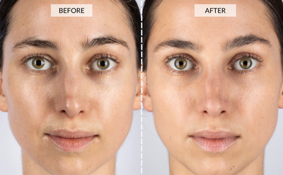 CurrentBody Skin LED 光療面膜儀