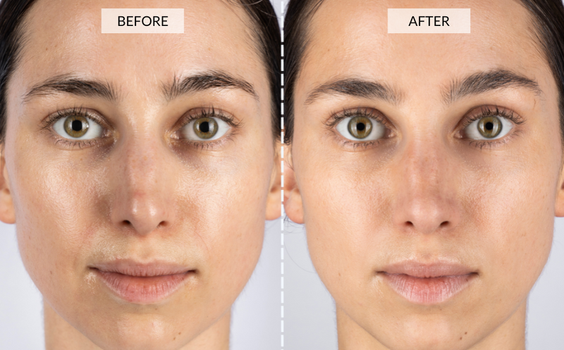 CurrentBody Skin LED 光療面膜儀