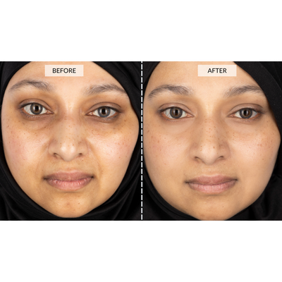 CurrentBody Skin LED 光療面膜儀