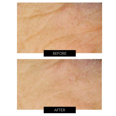 Dr. Levy Stem Cell Miracle Trial Set (worth £413)