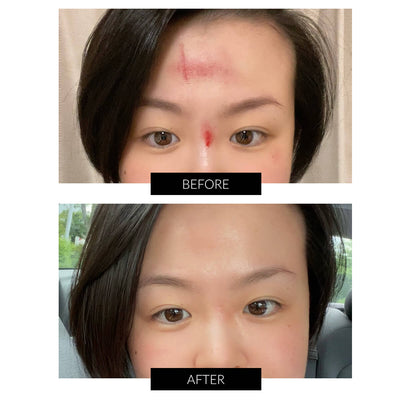 CurrentBody Skin LED 光療面膜儀