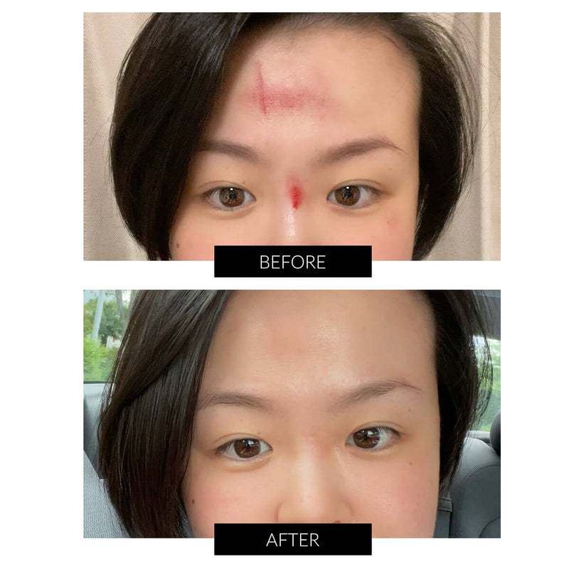 CurrentBody Skin LED 光療面膜儀