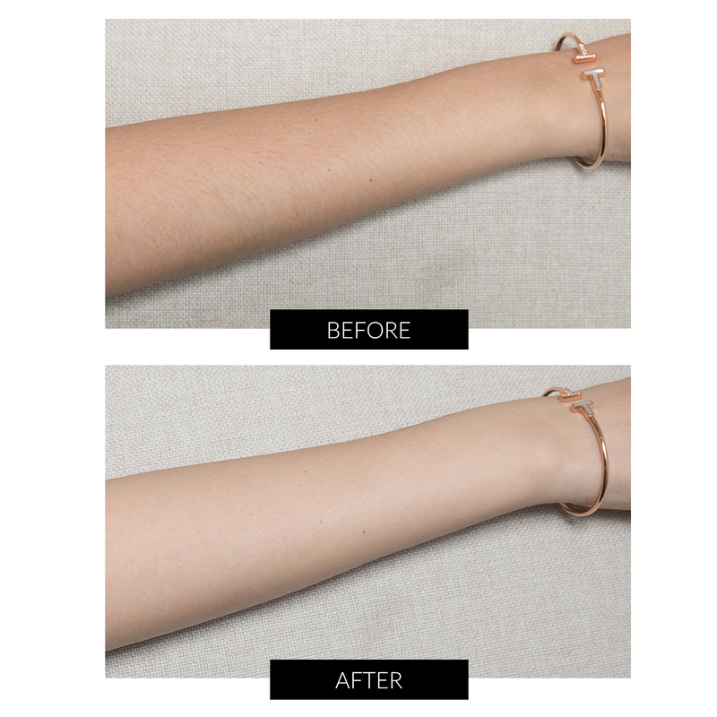 JOVS Mini Hair Removal Device | CurrentBody台灣站