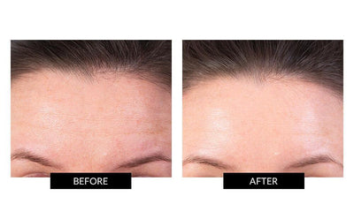 TriPollar STOP Vx + 2 CurrentBody Skin Radio Frequency Conductive Gel
